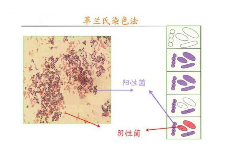 革兰氏染色 一种鉴别细菌的方法 搜狗百科