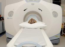 脑外伤后遗症的诊断