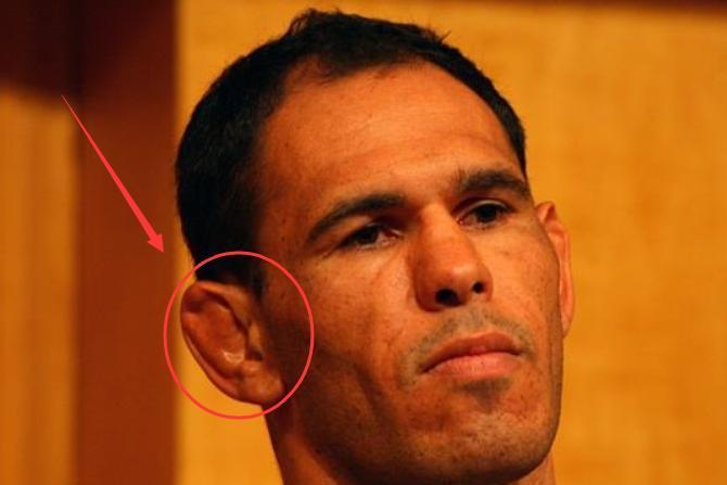 菜花耳 搜狗百科 菜花耳 搜狗百科