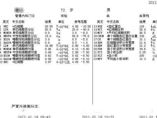 白血病的血常规 搜狗百科