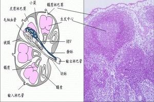 慢性颈淋巴结炎