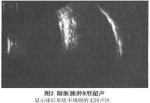眼眶脓肿