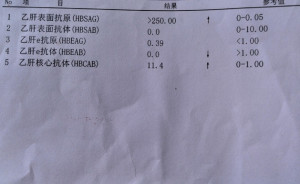 乙肝表面抗体阳性