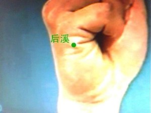 后溪穴
