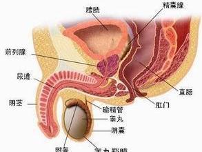 肉芽肿性前列腺炎