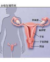 绝经后卵巢恶性肿瘤