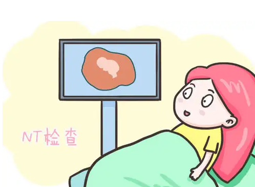 nt检查